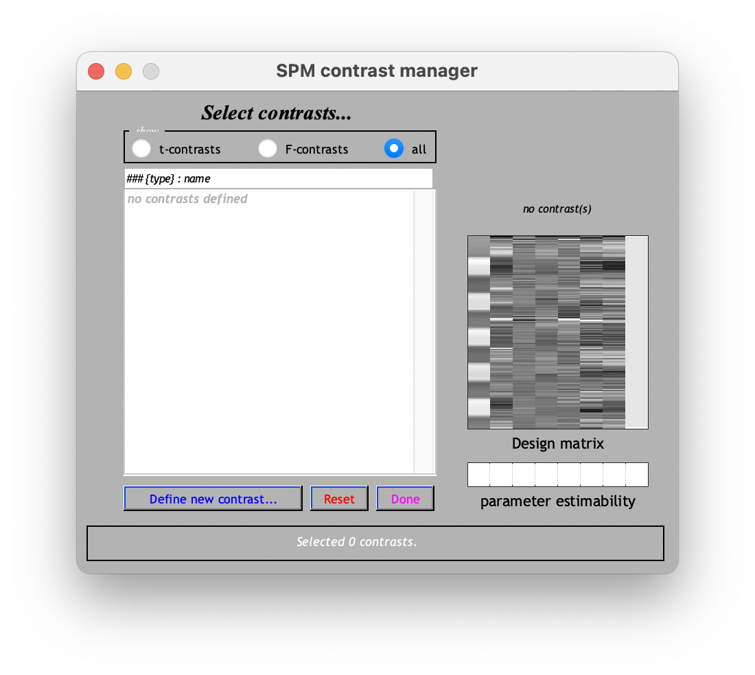 在 SPM contrast manager 中查看結果。