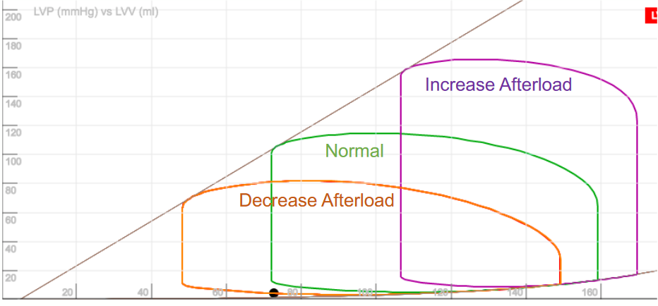 Afterload and PV Loop