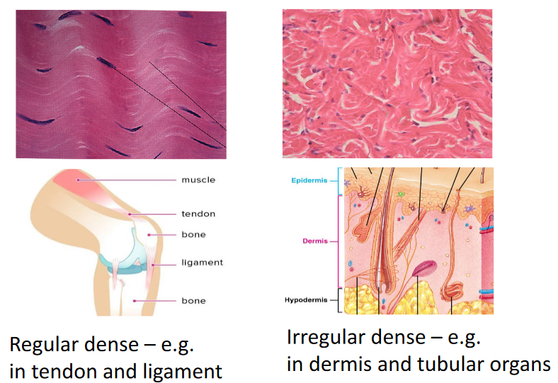 Types of Dense Connective Tissue