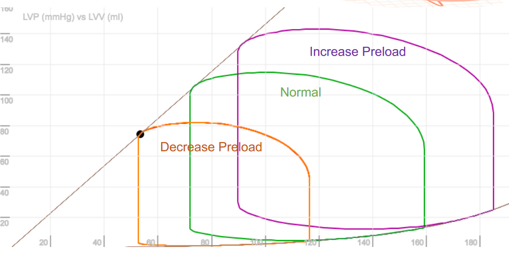 Preload and PV Loop