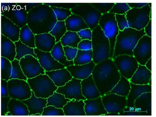 ZO-1-Stained Murine Hepatocytes in Tight Junctions