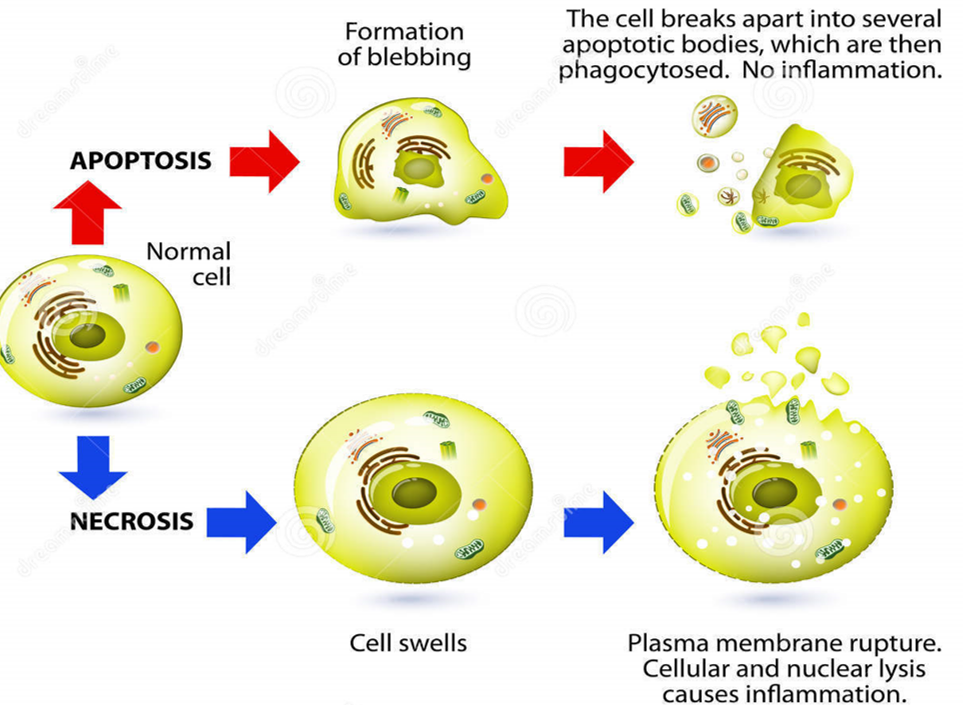 Differences Between Apoptosis and Necrosis