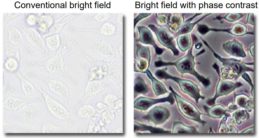 Comparison Betweeen Bright Field and Phase Contrast Microscopy on Live Cells