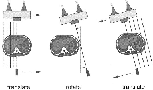 First Generation CT Scanners