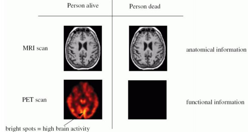 Anatomical versus Functional Imaging