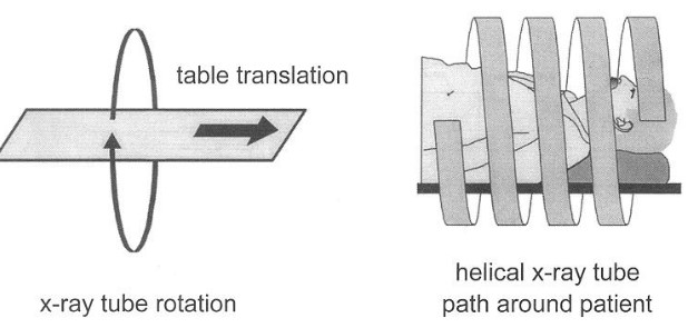 Illustration of a Helical CT Scanner