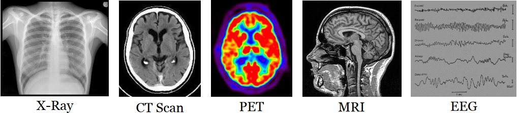 Different Kinds of Medical Images