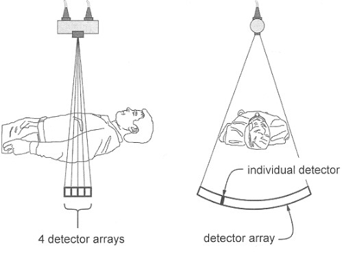 Illustration of a Seventh Generation CT Scanner