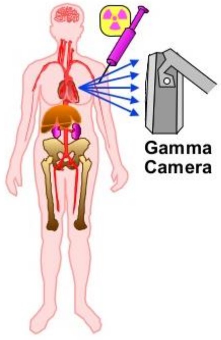 Workings of a Sample Nuclear Medicine Technique