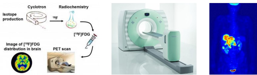 Workings of a PET scan