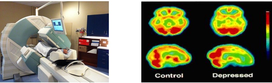 A SPECT Machine and its Results