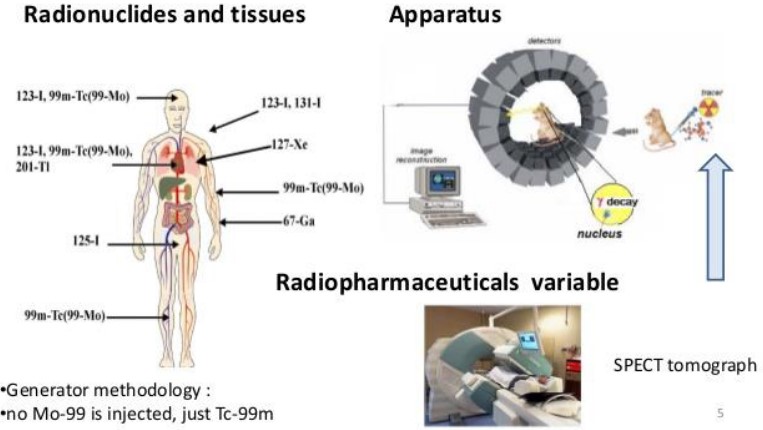 A SPECT conducted with Tc-99m