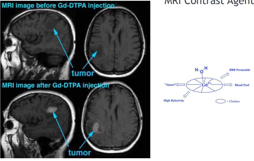 MRIs with and without Contarst Agents