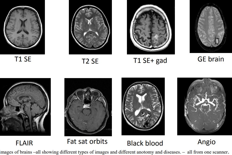 Differing MRI Scans of a Brain