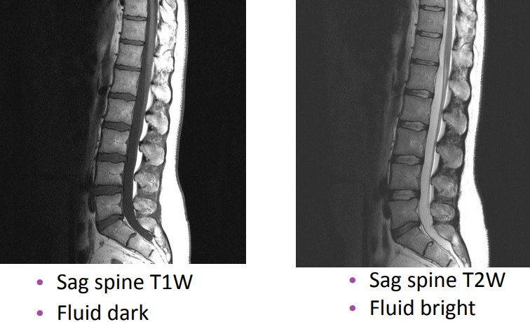 Differences Between T~1~ and T~2~ Weighted Images