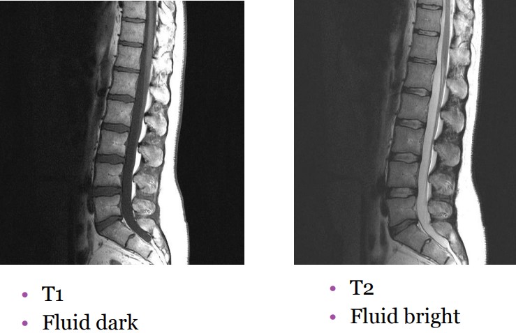 Types of MR Images