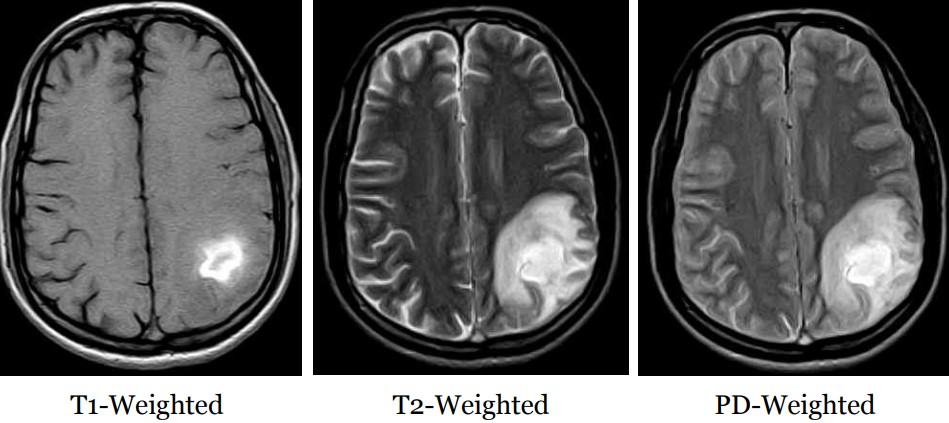 Proton Density Weighting