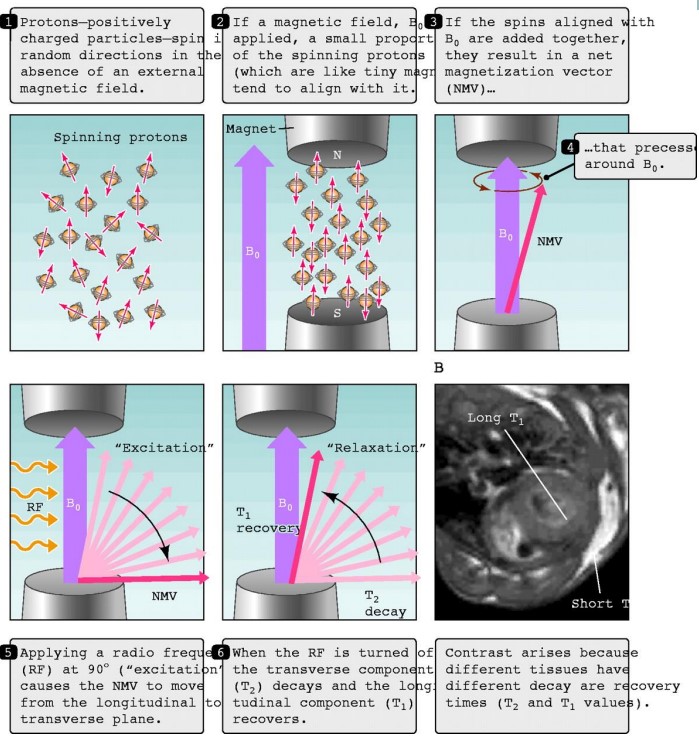 Procedure for Taking an MRI