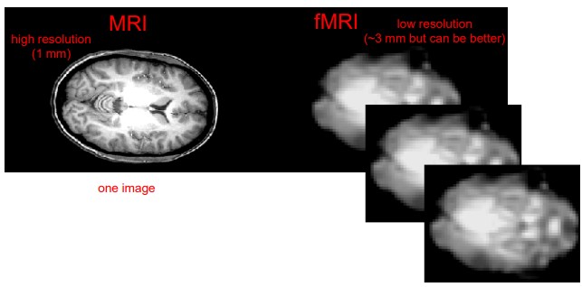 fMRI Images