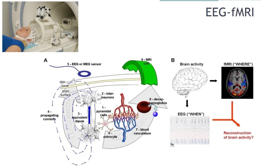 A schematic of a EEG-fMRI