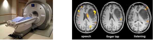 Functional MRI Device and Images