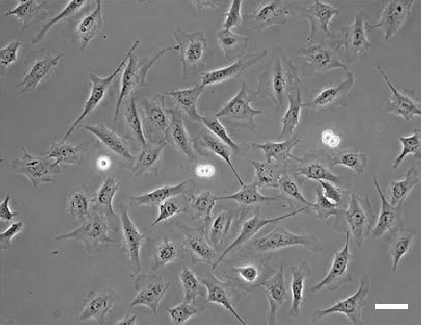 Phase Contrast Microscopy of Rat1 Cells