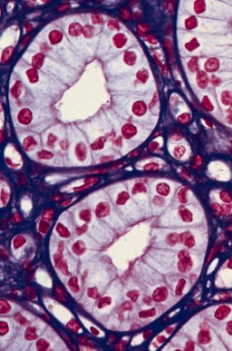 H&E Stained Kidney Cells Viewed with Bright Field Microscopy