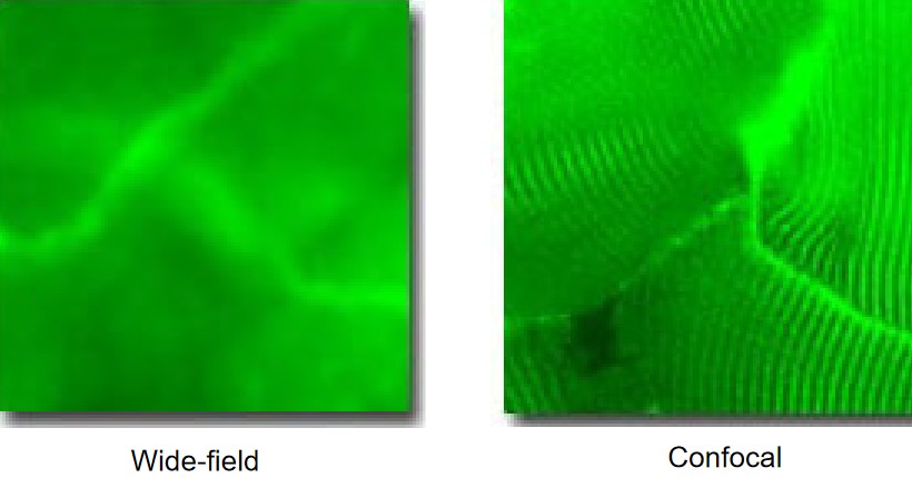 Rabbit Muscle Cells Viewed Under Wide-Field Fluorescence Microscopy