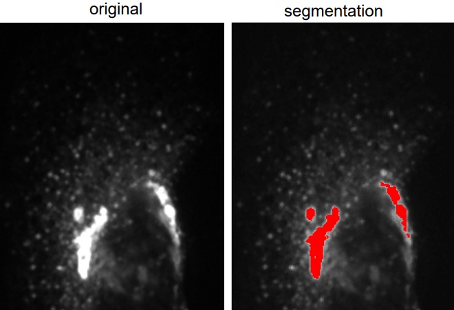 Comparison Between a Segmented and the Original Image