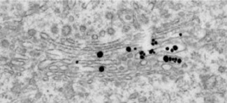 Immuno-Labeling of a Pre-Embedded Protein