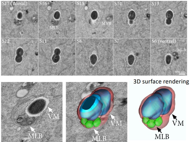 Serial Section TEM of Intracellular Bacteria