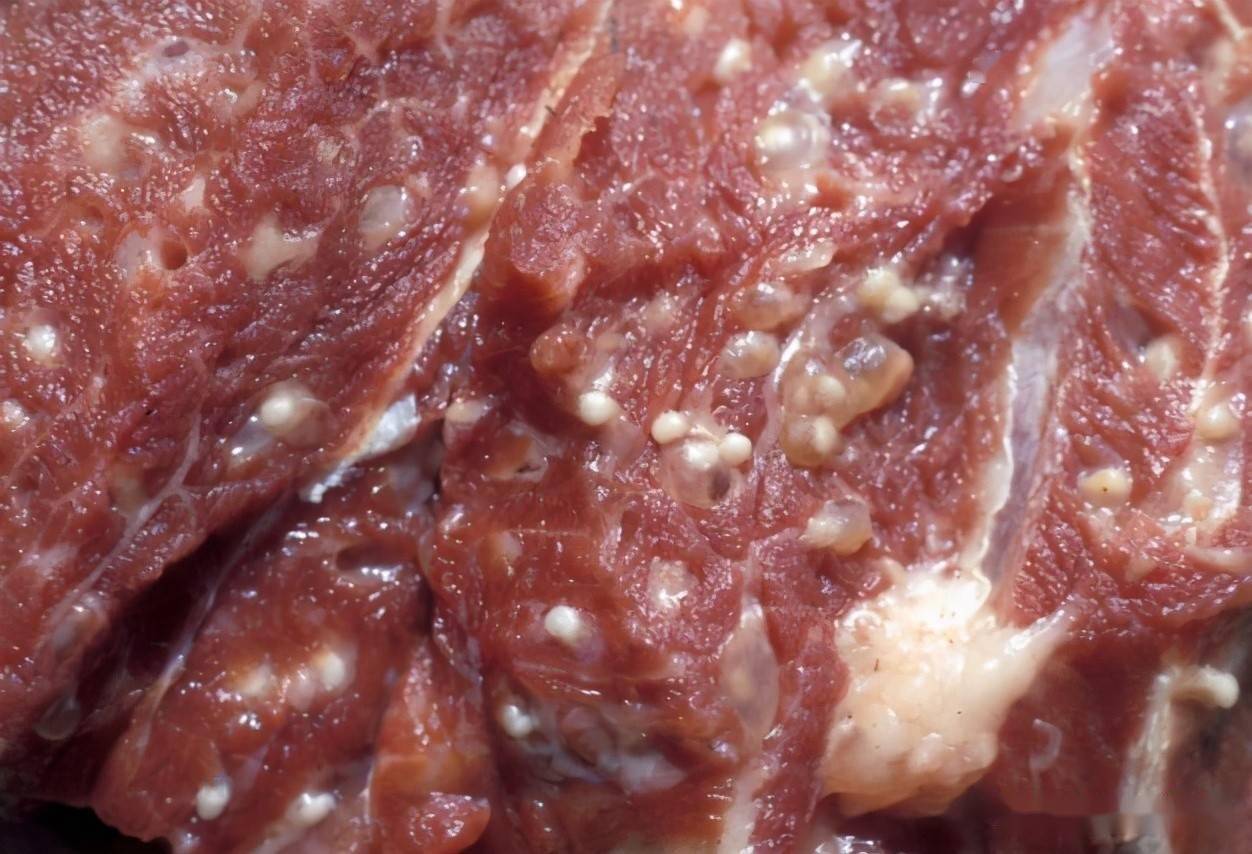 人体感染猪肉绦虫症状图片