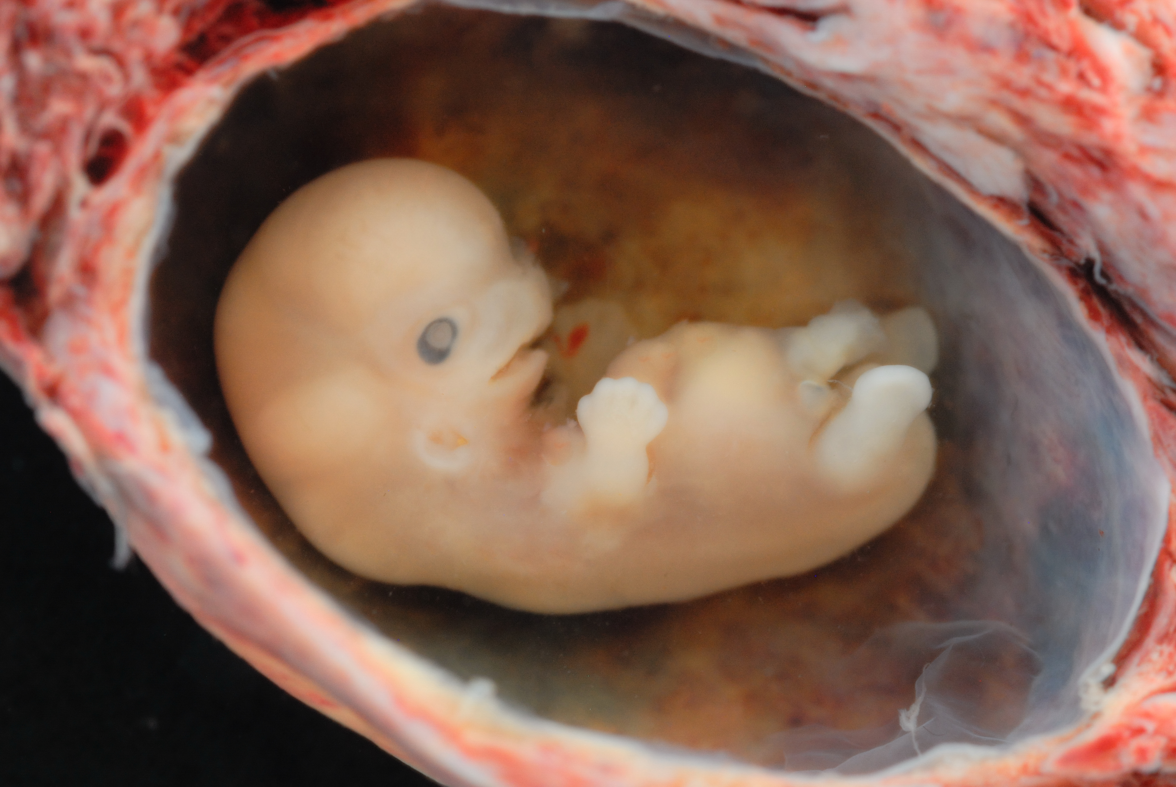 A tiny embryo depicting some development of arms and legs, as well as facial features that are starting to show.^[[Image](https://www.flickr.com/photos/28004184@N00/3233482244/) by [lunar caustic](https://www.flickr.com/photos/lunarcaustic/) is licensed under [CC BY 2.0](https://creativecommons.org/licenses/by/2.0/)]