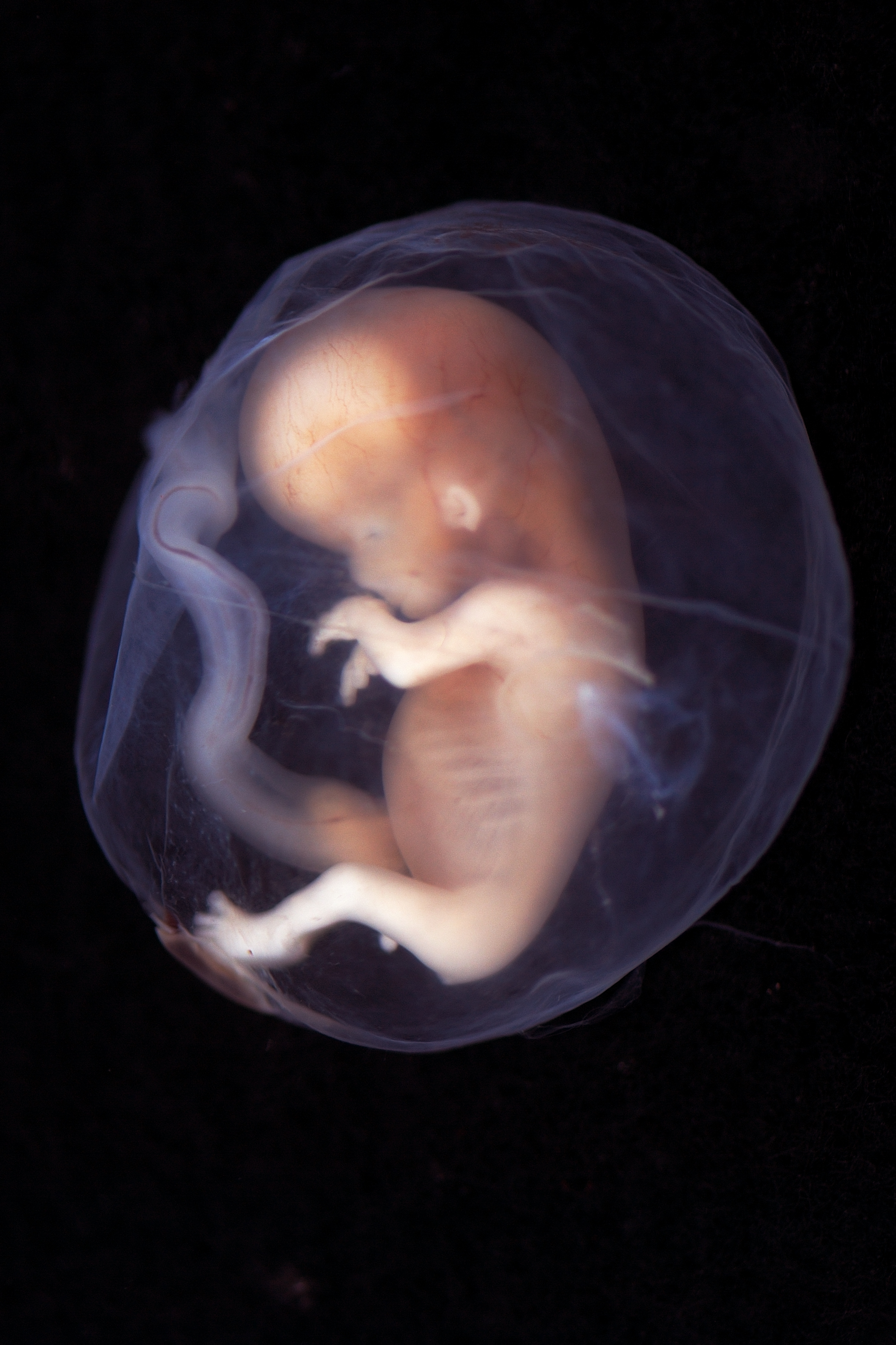 A human fetus.^[[Image](https://www.flickr.com/photos/lunarcaustic/2433149102/in/photostream/) by [lunar caustic](https://www.flickr.com/photos/lunarcaustic/) is licensed under [CC BY-SA 2.0](https://creativecommons.org/licenses/by-sa/2.0/)]