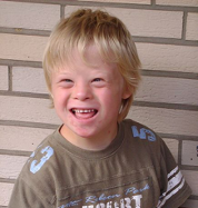 Down Syndrome is caused by the presence of all or part of an extra 21st chromosome.^[Image by [Vanellus Foto](https://commons.wikimedia.org/wiki/User:Vanellus_Foto) is licensed under [CC BY-SA 3.0](https://creativecommons.org/licenses/by-sa/3.0/deed.en)]