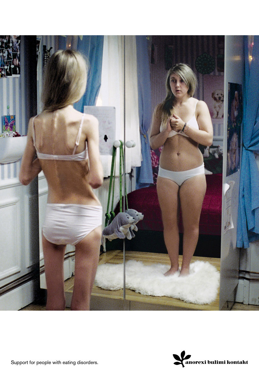 This image portrays anorexia. No matter how thin she is, she will see herself being heavier.^[[Image](https://www.flickr.com/photos/kairos_of_tyre/6317725969) by [Flebilis Roxa](https://www.flickr.com/photos/kairos_of_tyre/) is licensed under [CC BY-NC-SA 2.0](https://creativecommons.org/licenses/by-nc-sa/2.0/)]
