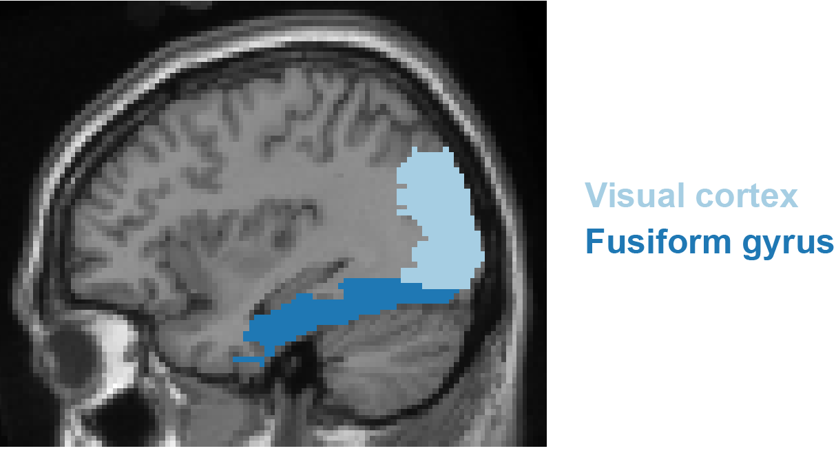 Location of the occipital cortex and fusiform gyrus.