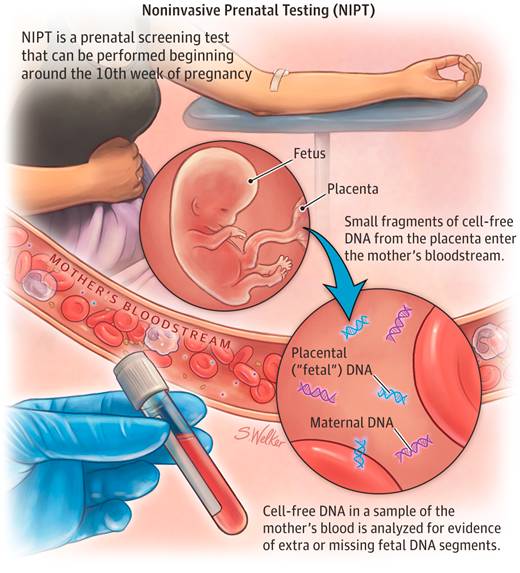 无创产检：抽母亲的血，查孩子的DNA。